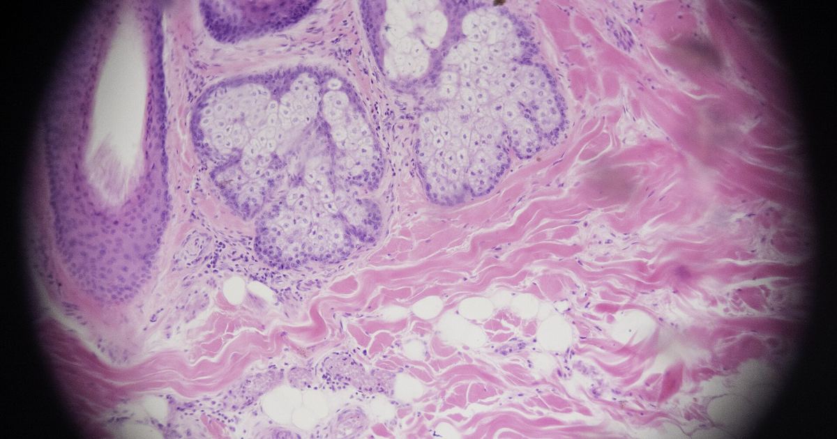 Stem Cell Migration in Skin Pigment Repair: 2021 Study Breakdown