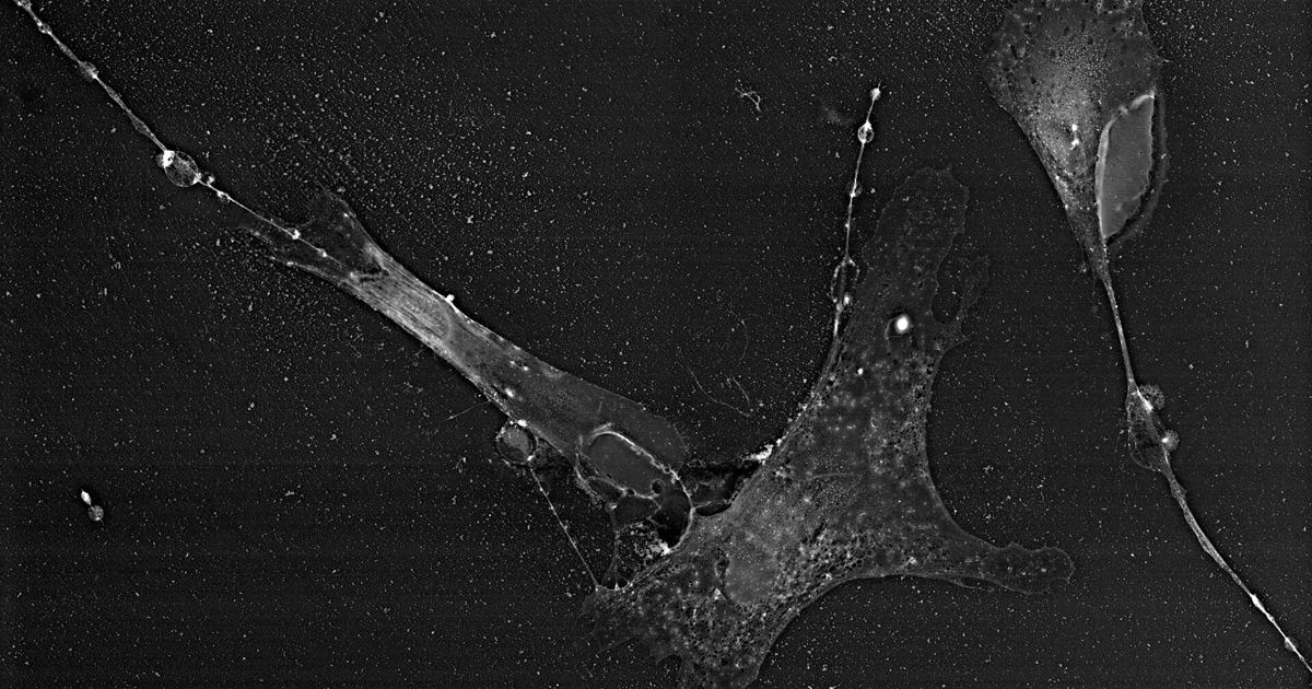 Single-Cell Sequencing of Blocked MC1R Melanocytes: FAQ