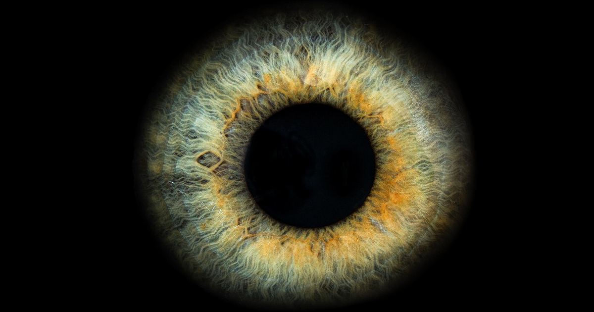 Oculocutaneous Albinism and Melanin: Key Numbers Breakdown