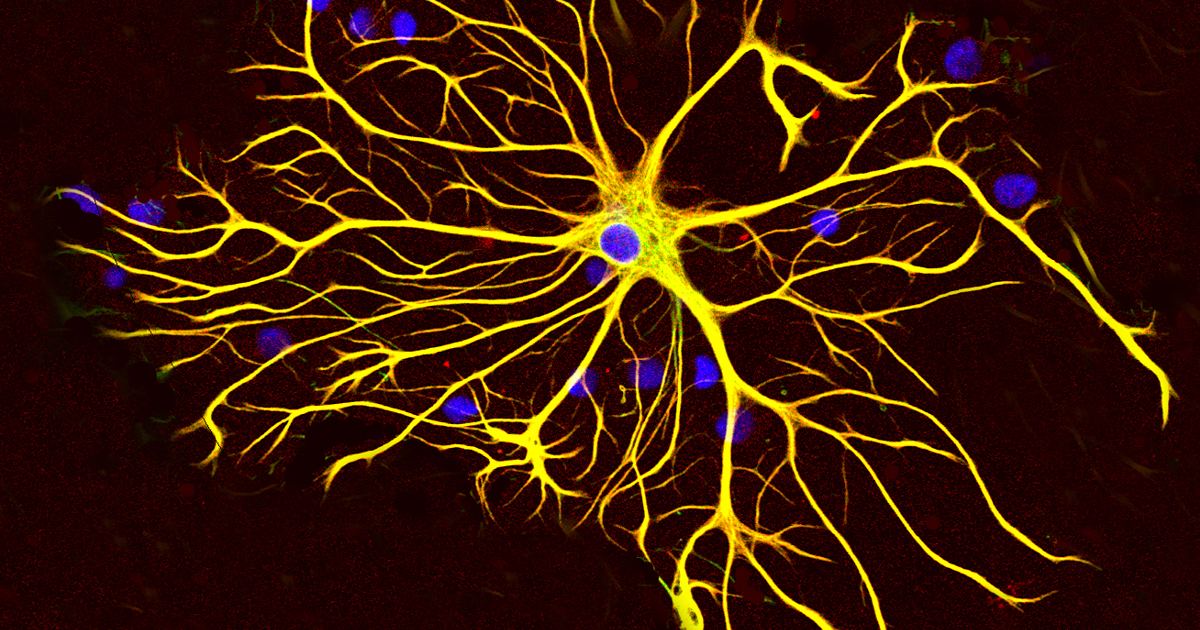 MC1R Variants and Sun Damage: Molecular Mechanisms Q&A