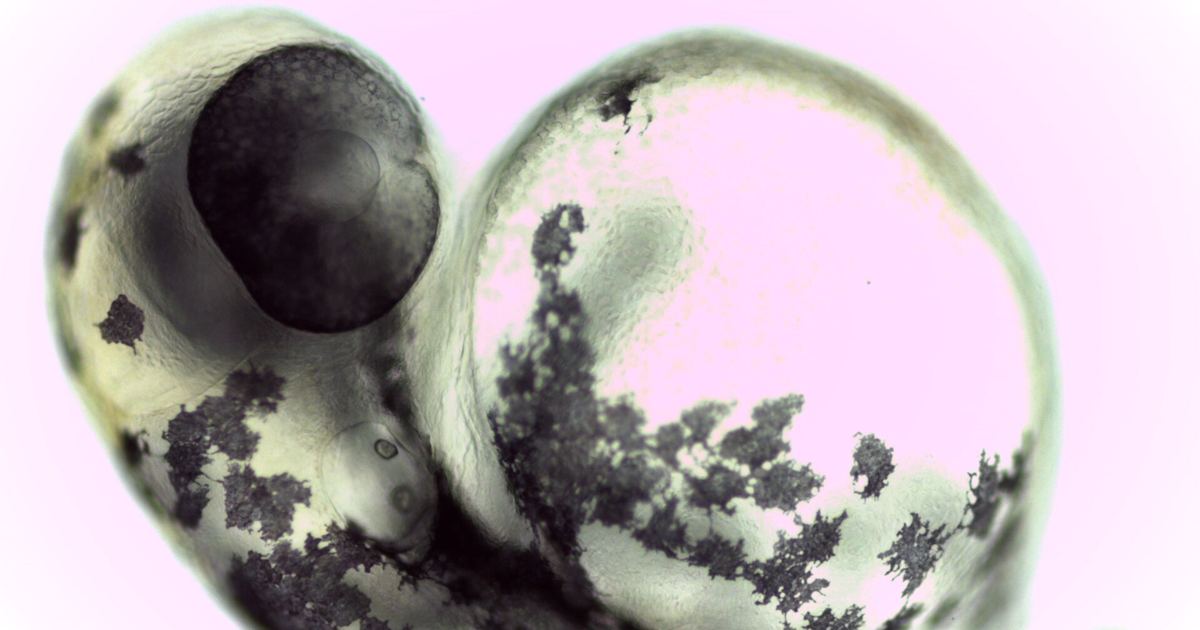 OCA2 and the P Protein: Melanosome pH and Pigment Facts