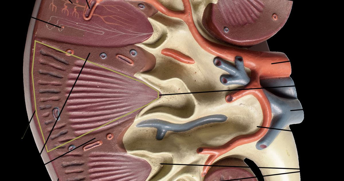 Melanotan II and Kidney Damage: Examining the Renal Infarction Case