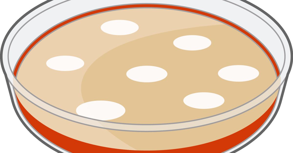 MC1R Palmitoylation and Melanoma Protection: FAQ