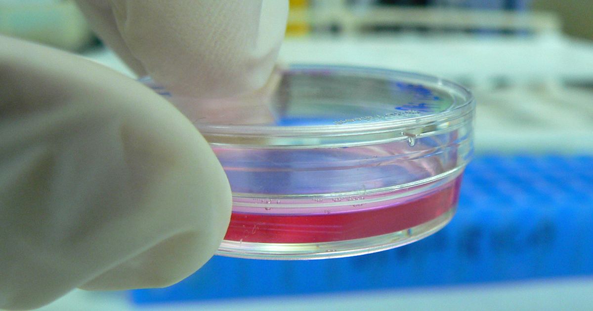 DHA and Skin Cells: FAQ on the 2020 Stress Response Study
